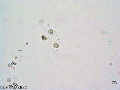 phyto/Thau_Lagoon/THAU_station1/GELAMED 2010/Eucampia zodiacus f. cylindrocornis (copy)_thumb.jpg